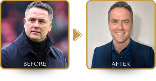 MICHAEL OWEN